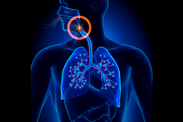 Airway Sleep Disorders