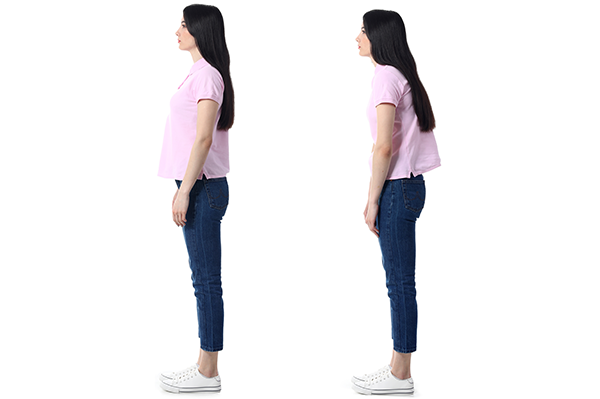 Postural Issues