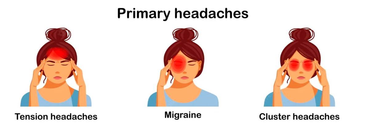 Types of Headaches Types of Headaches