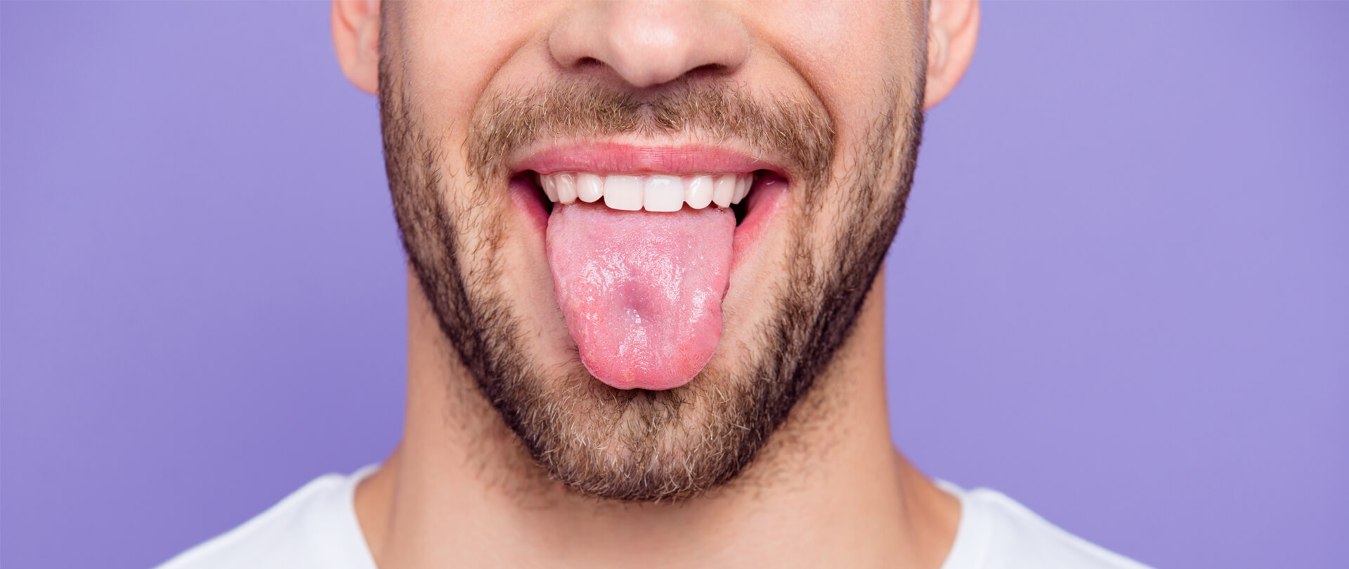 ankyloglossia, Sleep Disorders, TMJ 