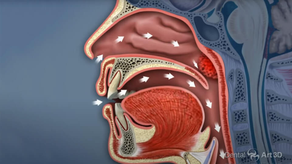 Airway and TMJ