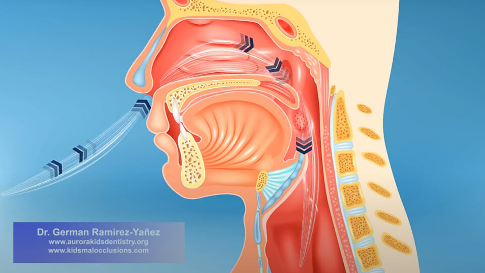 Airway Orthodontics Approach