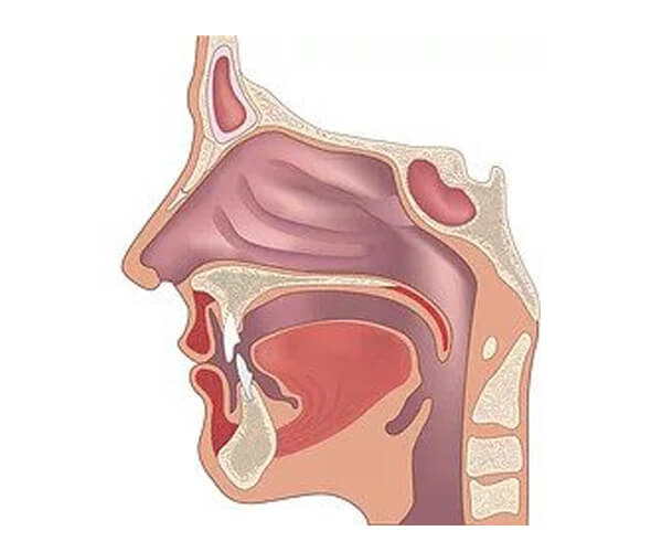 airway airway