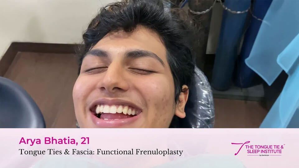 Fascia Releases, Head Shoulders, Knees and Toes - At The Tongue Tie & Sleep Institute By Dentician
