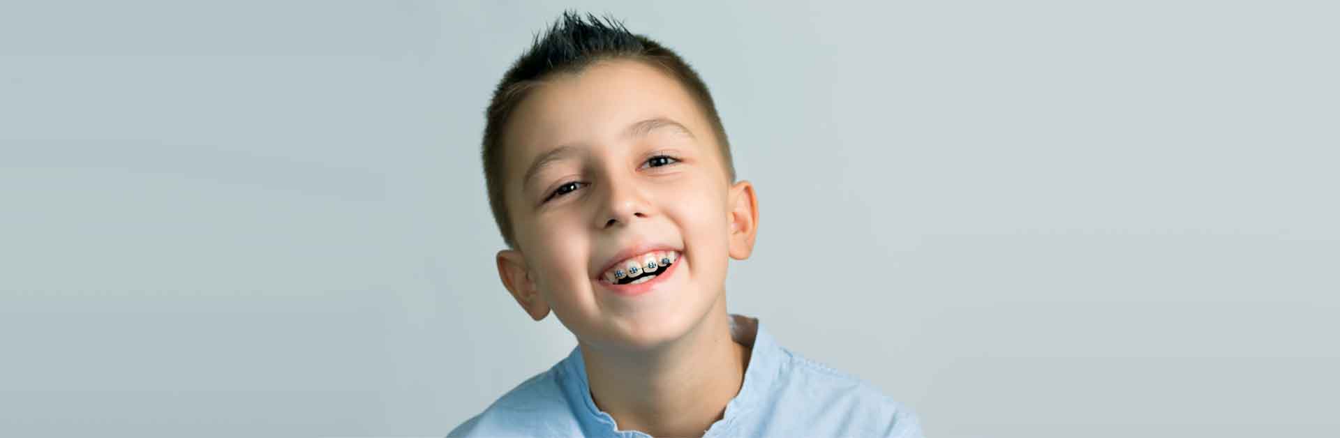 BRACES AND MYOBRACE: A GUIDE