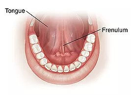 tongue tie in toddlers tongue tie in toddlers
