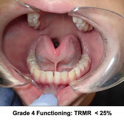 grade 4 functioning trmr grade 4 functioning trmr