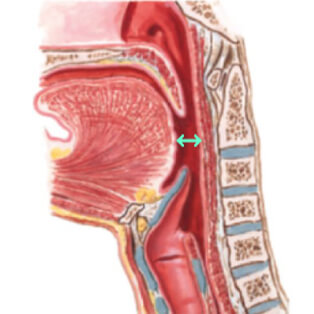 normal low tongue posture normal low tongue posture