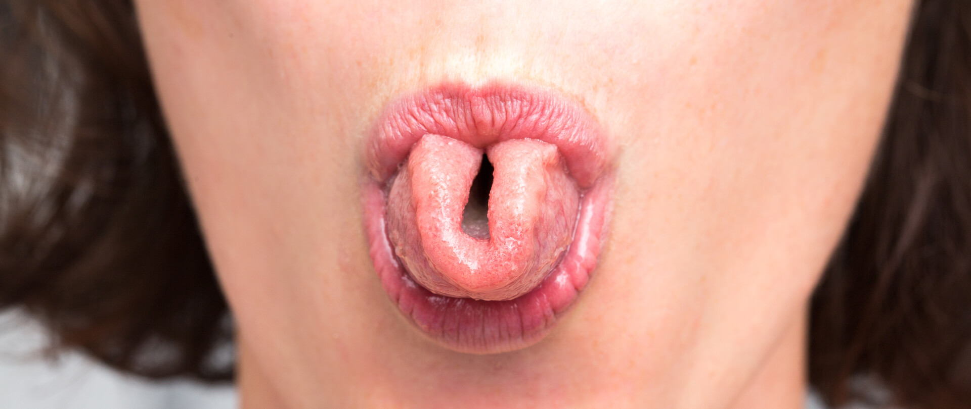 Tongue Ties & TMJ, Grinding & Bruxing 